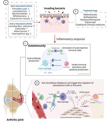 Gut microbiota and rheumatoid arthritis: From pathogenesis to novel therapeutic opportunities